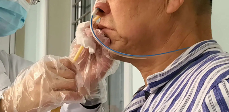 科学吞咽训练，重享美食风味